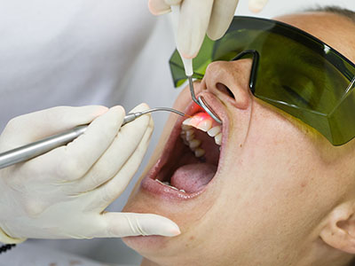 Acora Dental | Periodontal Treatment, Snoring Appliances and Dental Cleanings